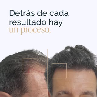 Este resultado es mucho más que un antes y un después. Es el reflejo de un tratamiento personalizado