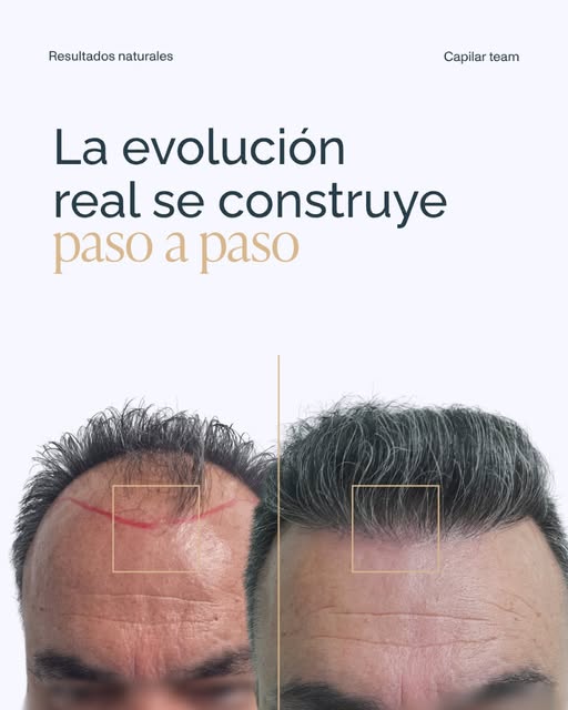 Precisión en cada detalle. Cuidado en cada paso.

Un antes y un después que va mucho más allá de una
