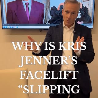 In my opinion, the “king” of facelifts is the #deepplanefacelift.  It’s the only approach that adequ