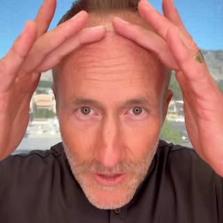 so much more than just a hair transplant...
·
#hairtransplant #fue #trusttheprocess #hairgrowth #men