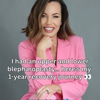 Ask me a question about my blepharoplasty surgery and I’ll answer you! 

Thank you @drjohnbitner for