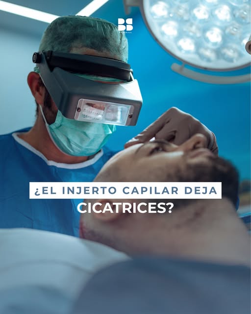 🔎 ¿El injerto capilar deja cicatriz? Es una de las dudas más frecuentes antes de dar el paso.

Con 