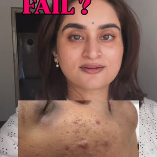 Understand before you change skincare 👩‍⚕️