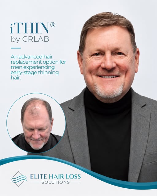 What if a Hair System could be customized to look, feel, and move like your own hair?

Meet iTHIN® b