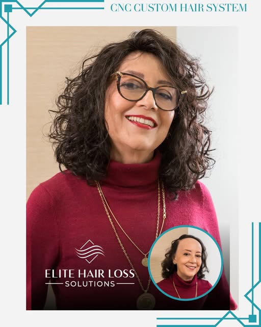A great transformation isn't simply about restoring coverage. It's about creating hair that looks an