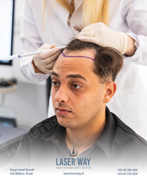 20 Anni di Esperienza nel Trapianto di Capelli!

Dopo due decenni, la Laser Way Clinic è diventata s