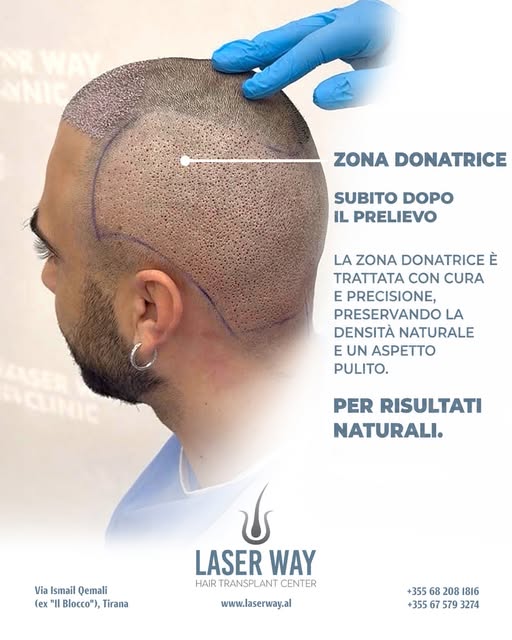 20 Anni di Esperienza nel Trapianto di Capelli!

Dopo due decenni, la Laser Way Clinic è diventata s
