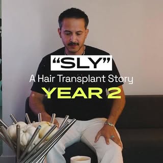This is Year 2.

SLY: A Hair Transplant Story
Now on YouTube.