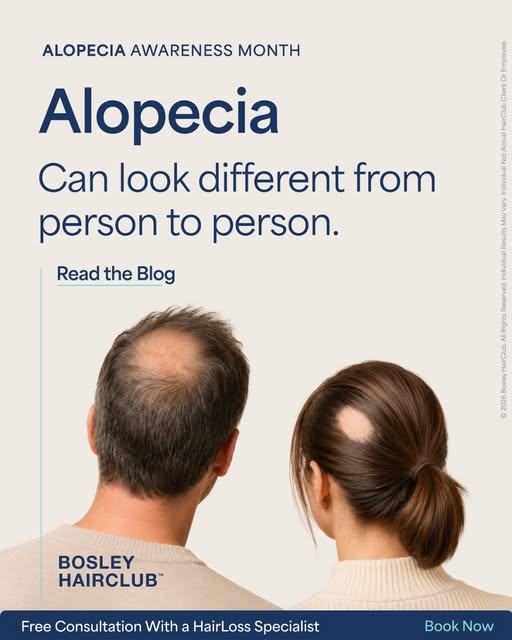 Alopecia can look different from person to person, which is why treatment shouldn't be one-size-fits