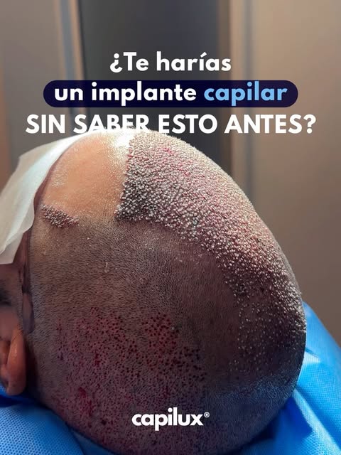 UN CAMBIO DE IMAGEN CON EXCELENTE RESULTADO EMPIEZA POR UNA BUENA ASESORÍA.✔️

En Capilux priorizamo