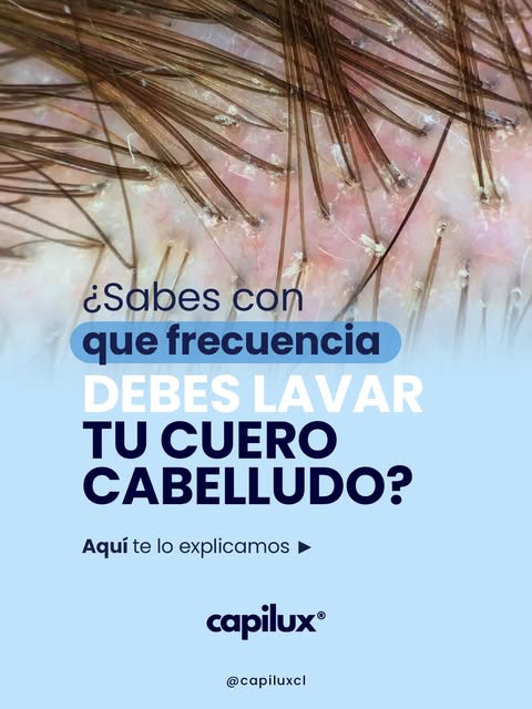 EL VERDADERO SECRETO PARA EL CUIDADO DEL CABELLO ESTÁ EN LA RAÍZ.

Un cuero cabelludo descuidado es 