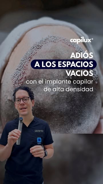 UNA FRASE QUE A DIARIO ESCUCHO EN CONSULTA: “DOCTOR, YA NO SÉ CÓMO PEINARME PARA DISIMULAR LAS ENTRA