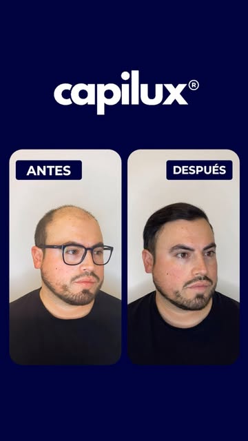 DETRÁS DE CADA TRANSFORMACIÓN EXITOSA HAY UN PLAN MÉDICO PERSONALIZADO.

Hoy les comparto la histori