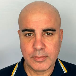 With Scalp Micropigmentation, there are also large projects where people have almost no hair left. 
