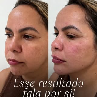 Não é sobre parecer outra pessoa. É sobre se reconhecer na sua melhor versão.

Cada detalhe foi pens