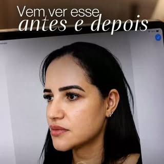 A verdadeira harmonização facial começa muito antes do primeiro procedimento.

Tudo começa com uma a