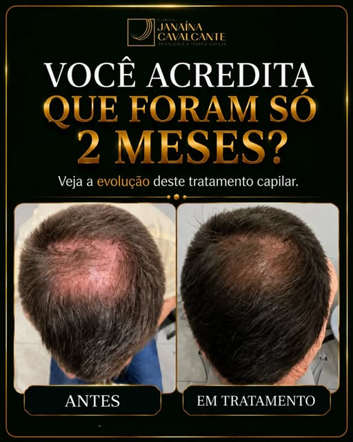 Agora imagine os seus cabelos daqui a dois meses com o nosso tratamento? 
Se você quer resultados de