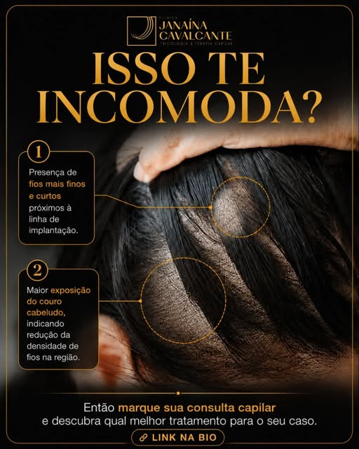 Você prende o cabelo, muda a risca, tenta disfarçar... mas aquela região mais rala continua te incom