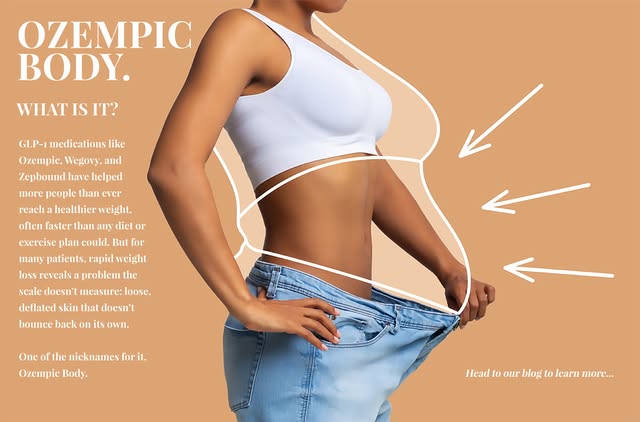 You reached your goal weight… but what happens next? 👀
GLP-1 medications like Ozempic have transfor