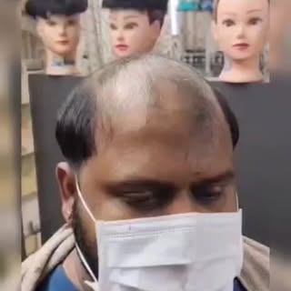 🔥 Hair Loss తో ఇబ్బంది పడుతున్నారా? Bald Look వల్ల Confidence తగ్గిందా?

ఇప్పుడే solution ఉంది!
RS 