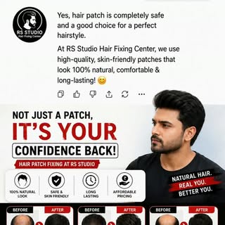 CALL NOW 7337458989
#fypppppppppppppppppppppppppppppppppppppppppppppppppppppppppppppppppppppp #hairf