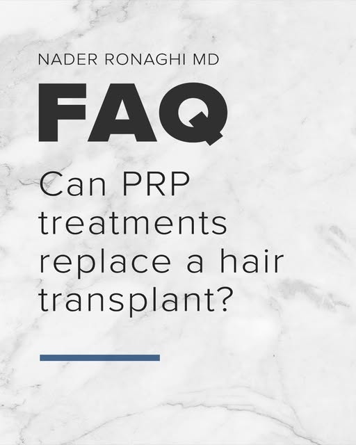 💡FAQ: Can PRP treatments replace a hair transplant?

 Not necessarily. PRP and hair transplantation