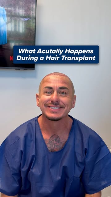 What actually happens during a hair transplant? 👀

It starts with a plan. We design the hairline ba