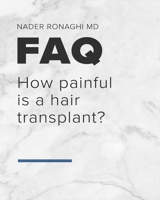 FAQ: How painful is a hair transplant?💡 

Most patients are surprised by how comfortable a hair tra