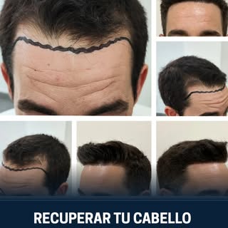 🩺 Cada tratamiento comienza con un estudio personalizado para comprender qué necesita realmente tu 