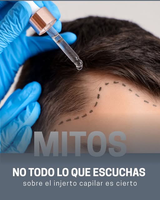 🔬 Existen muchas creencias que generan dudas antes de iniciar un tratamiento capilar. Contrastar la