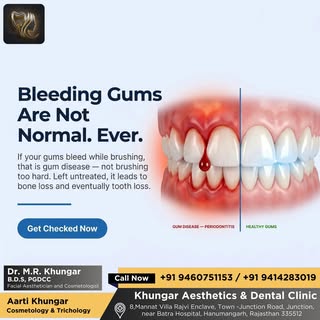 If your gums bleed while brushing, that is a sign of gum disease, not of brushing too hard. Left unt