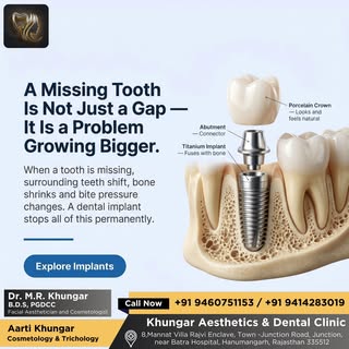A missing tooth is rarely just a gap. Surrounding teeth begin to shift, bone gradually shrinks and b