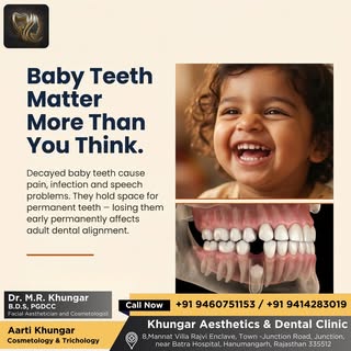 Decayed baby teeth can cause pain, infection and even speech difficulties. They also hold space for 