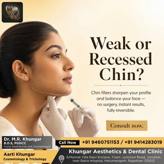 A weak or recessed chin can affect the overall balance of the face. Chin fillers help sharpen the pr