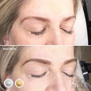 [Nano Brows]
⭐️⭐️⭐️⭐️⭐️
 ***Healed results can vary per individual.
.
.
Book an appointment today wi