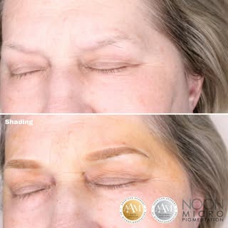 [Shading]
⭐️⭐️⭐️⭐️⭐️
 ***Healed results can vary per individual.
.
.
Book an appointment today with 
