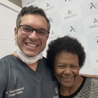 O transplante capilar na Alopécia frontal fibrosante (AFF) é sempre um desafio. Quando conheci a his