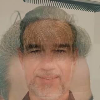 ✔️ Transformando Vidas! 

• Esse resultado pode não ser reproduzível para todos os pacientes devido 