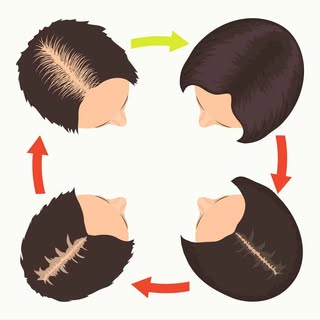 Don't let your hairloss get you down.  There is something you can do about it!  Give us a call at 87