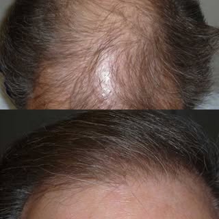Discover a New You!
☎️Call us at (586)756-4009📲
#hairandfacialplasticsinstitute #hair #hair4men #ha
