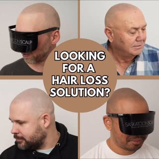 Looking for a solution for hair loss?

Check out Scalp Micropigmentation (SMP) which is a realistic,