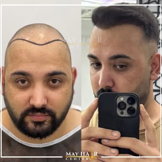 May hair center 

İletişim 

☎️ +90 533 634 30 04
☎️ +90 542 138 46 08