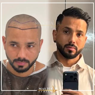 May hair center

İletişim 

☎️+90 533 634 30 04
☎️+90 542 138 46 08