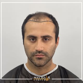 May hair center. 4500 Greft

İletişim 

☎️ +90 533 634 30 04
☎️ +90 542 138 46 08