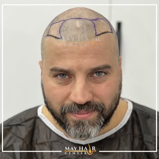 May hair center. 4500 Greft 

İletişim

☎️ +90 533 634 30 04
☎️ +90 542 138 46 08