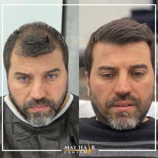 May hair center. 4500 Greft

İletişim

☎️ +90 533 634 30 04
☎️ +90 542 138 46 08