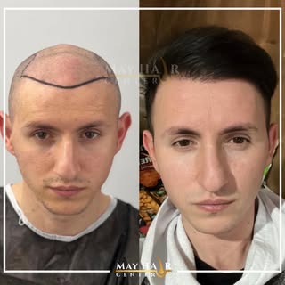 May hair center 4500 Greft

İletişim 

☎️ +90 533 634 30 04
☎️ +90 542 138 46 08