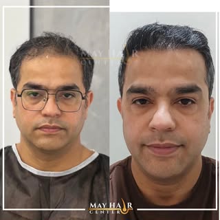 May hair center. 4500 Greft 

İletişim 

☎️ +90 533 634 30 04
☎️ +90 542 138 46 08