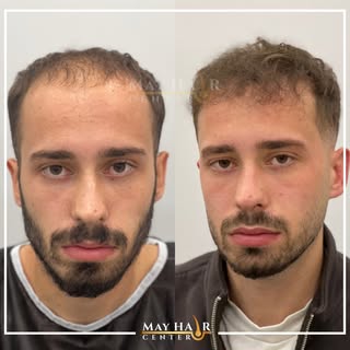 May hair center 4500 Greft

İletişim 

☎️ +90 533 634 30 04
☎️ +90 542 138 46 08
