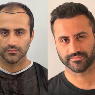 May hair center 4500 Greft

İletişim 

☎️ +90 533 634 30 04
☎️ +90 542 138 46 08